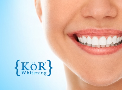 Closeup of smile after KoR teeth whitening treatment