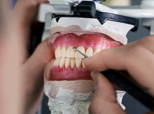 A pair of dentures being made at a dental laboratory