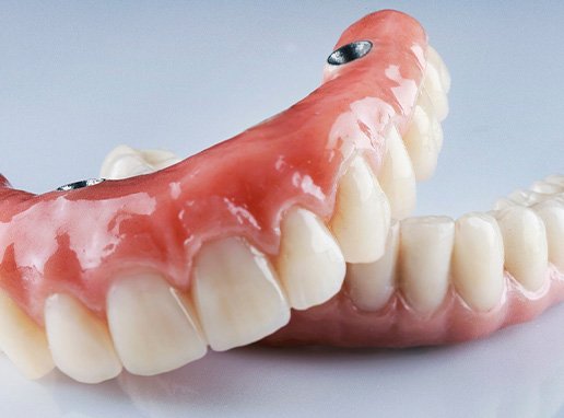 A pair of implant dentures