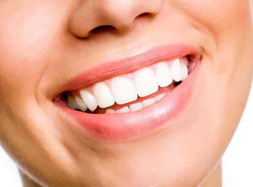 Healthy smile after dental hygiene cleaning visit