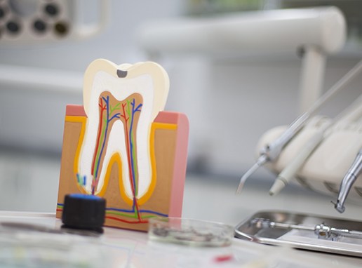 Model of healthy tooth that doesn't need root canal therapy