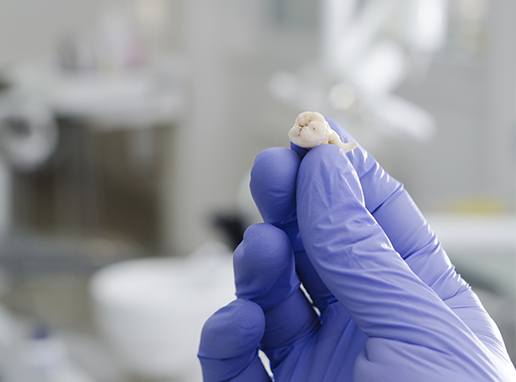 Hand holding an extracted tooth