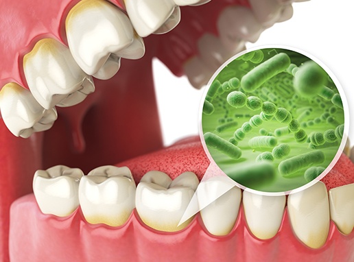 Animated smile with magnified view of oral bacteria